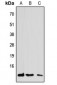 Anti-CCL7 Antibody